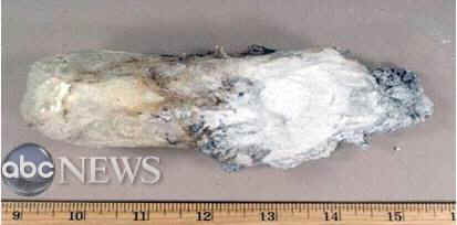 http://abcnews.go.com/images/Blotter/abc_c_PETN_underwear_091228_main.jpg